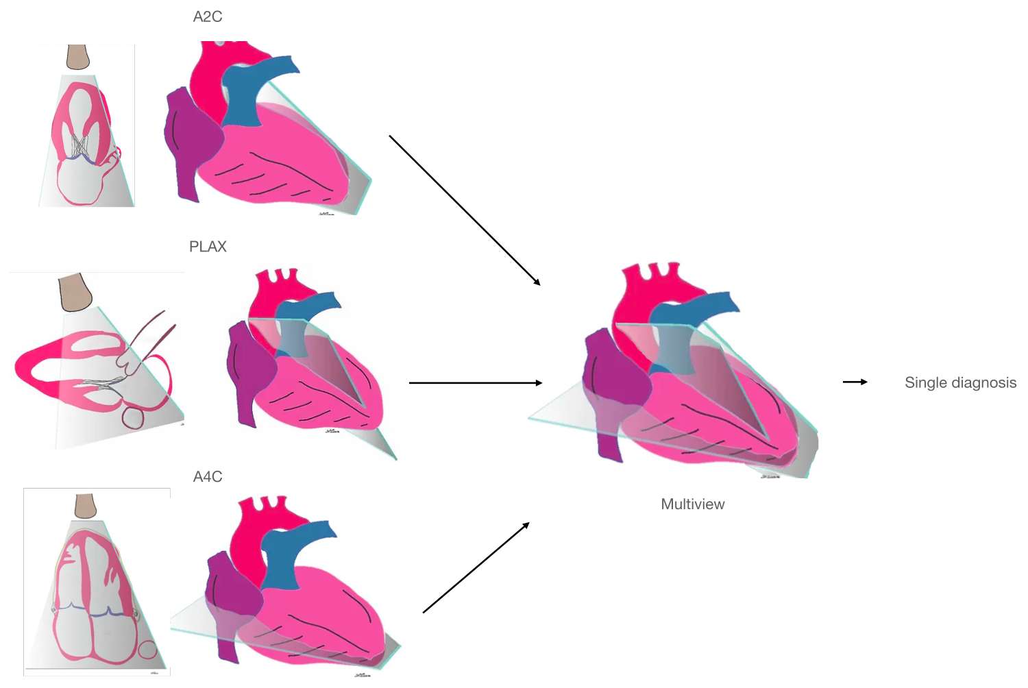 Application to echocardiography illustration
